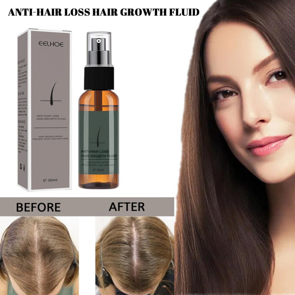 Hair Growth Products Regrowth Nourishing Ginger Spray