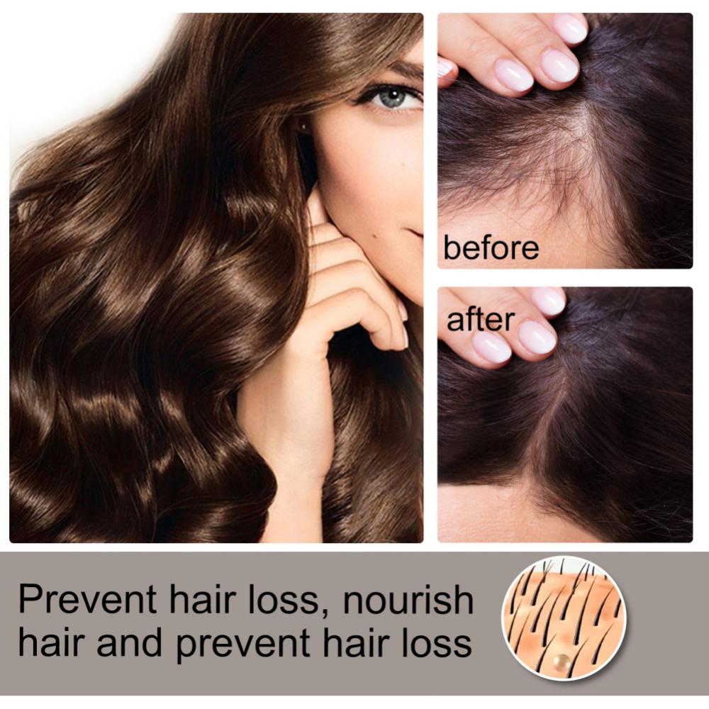 Hair Growth Products Regrowth Nourishing Ginger Spray