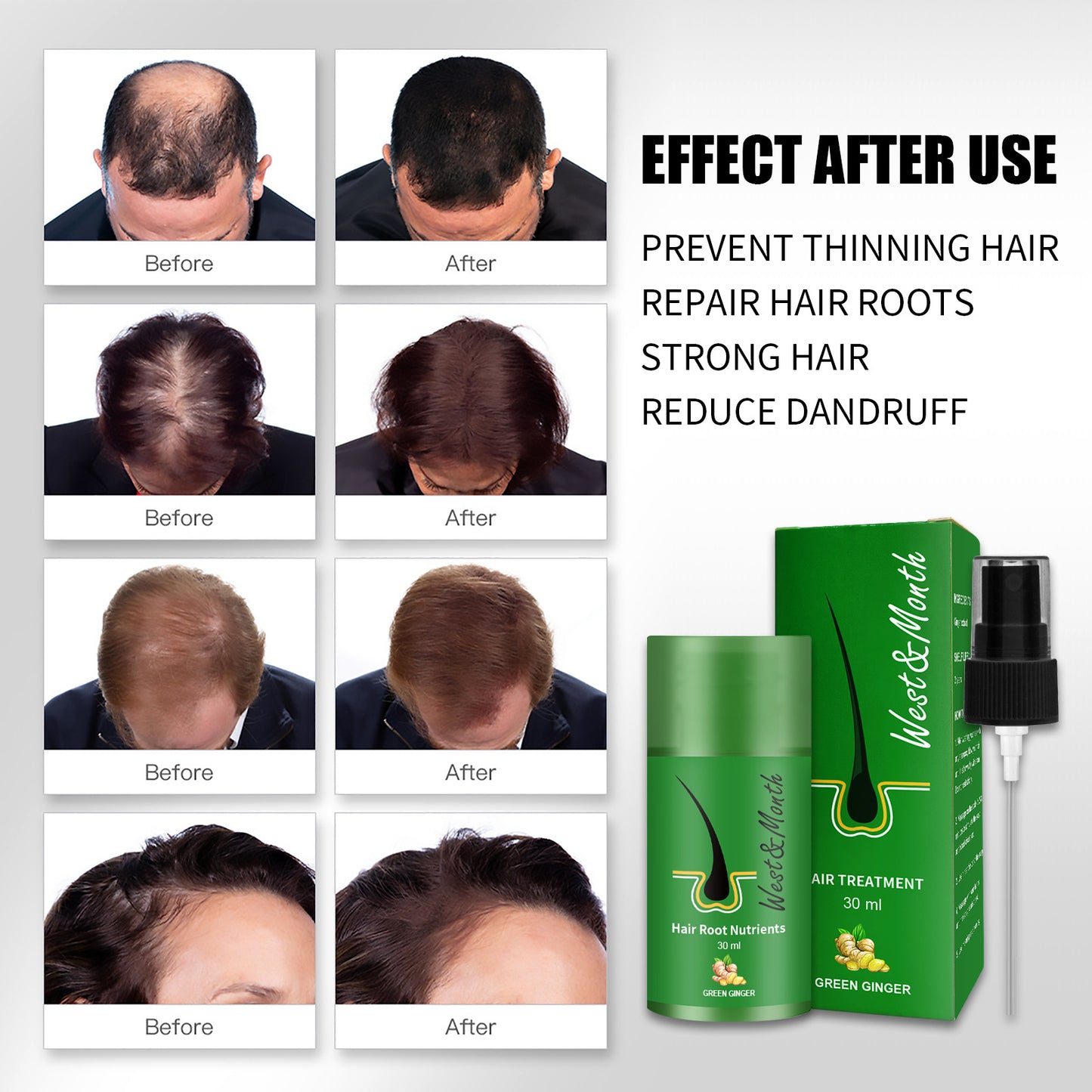 Plant Anti-U-turn Growth Hair Follicle Black Hair Growth Nutrient Solution