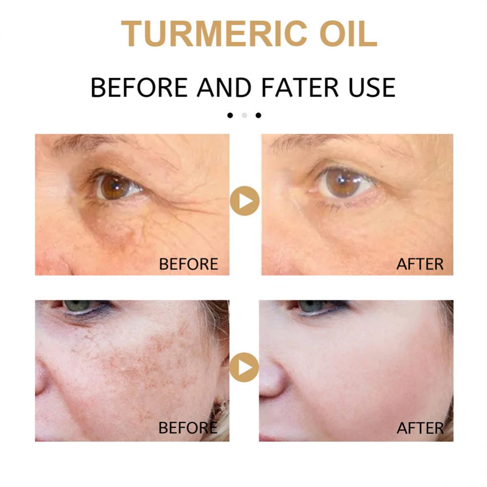 Turmeric Dark Spot Moisturizing Improve Skin Tone Witening Cream Face Care