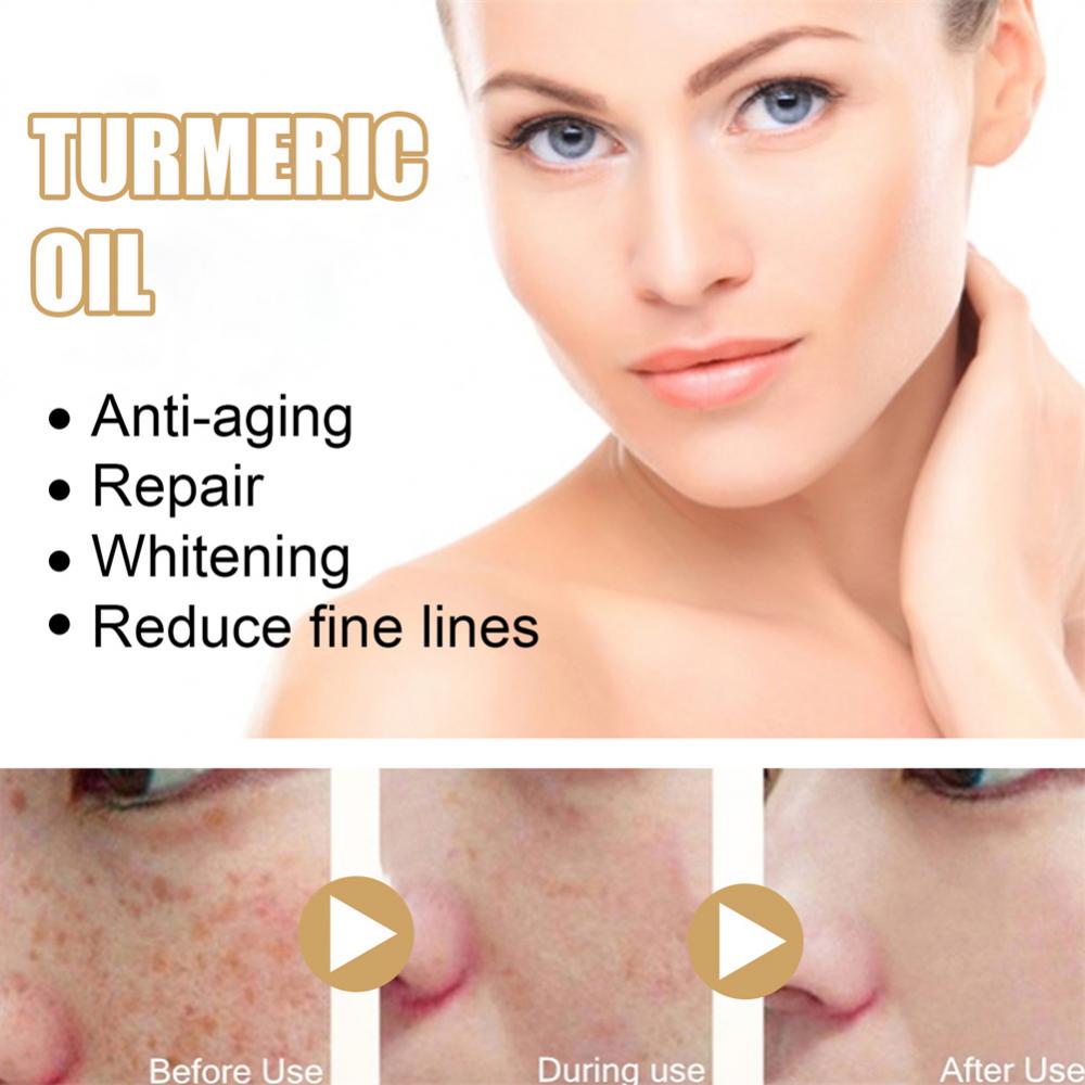 Turmeric Dark Spot Moisturizing Improve Skin Tone Witening Cream Face Care