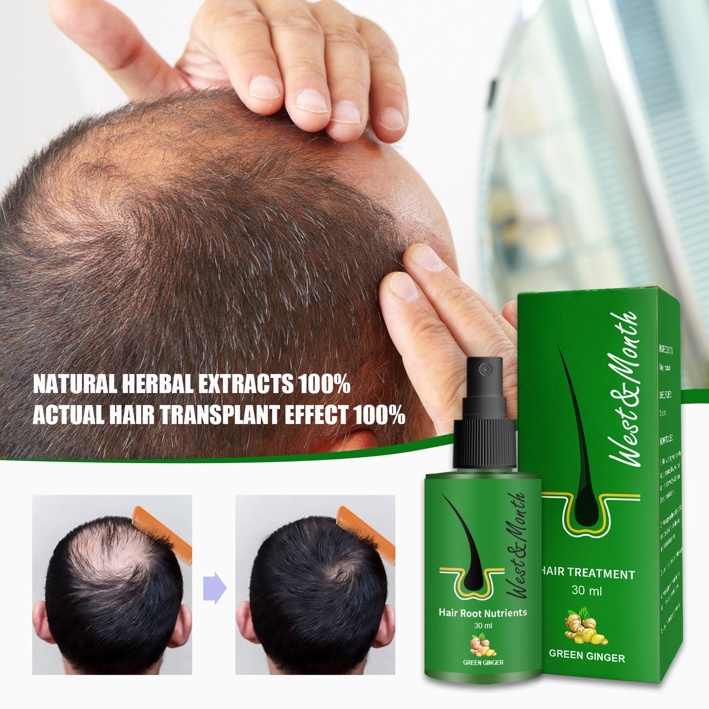 Plant Anti-U-turn Growth Hair Follicle Black Hair Growth Nutrient Solution