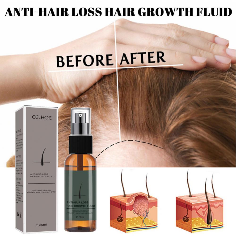 Hair Growth Products Regrowth Nourishing Ginger Spray